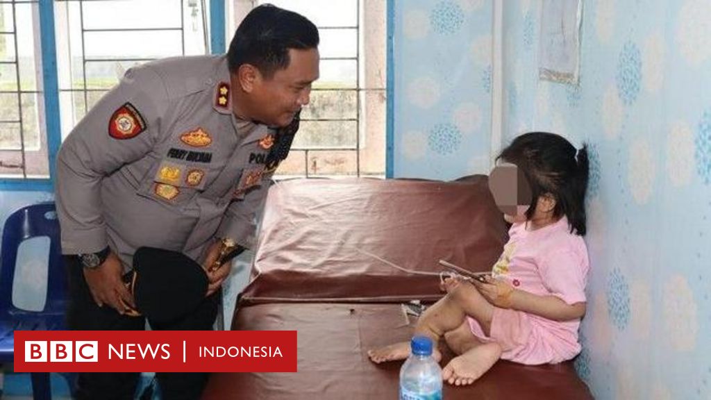 viral tante bocah Kasus bocah patah kaki permanen di Nias, tante korban jadi tersangka - BBC  News Indonesia
