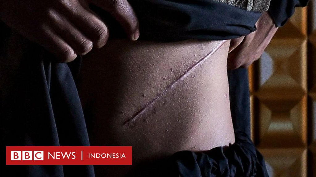 Kesaksian warga Myanmar yang nekad jual-beli ginjal di India demi menyambung hidup - 'Saya hanya ingin punya rumah dan melunasi utang'