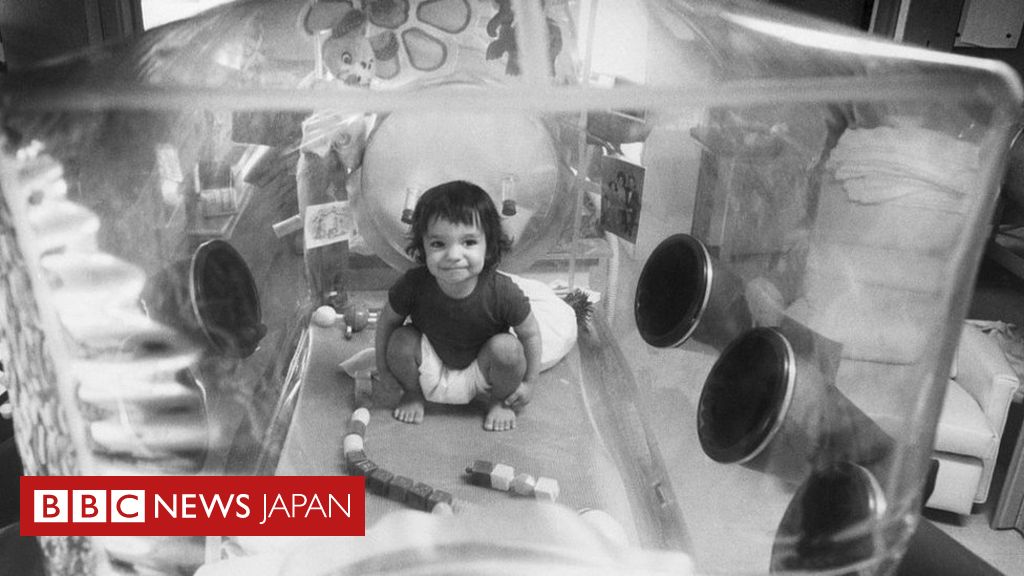 南山堂 / 感染症学 / 免疫不全者の呼吸器感染症