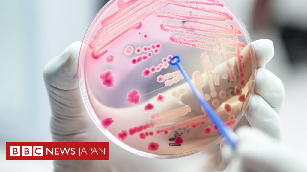 敗血症