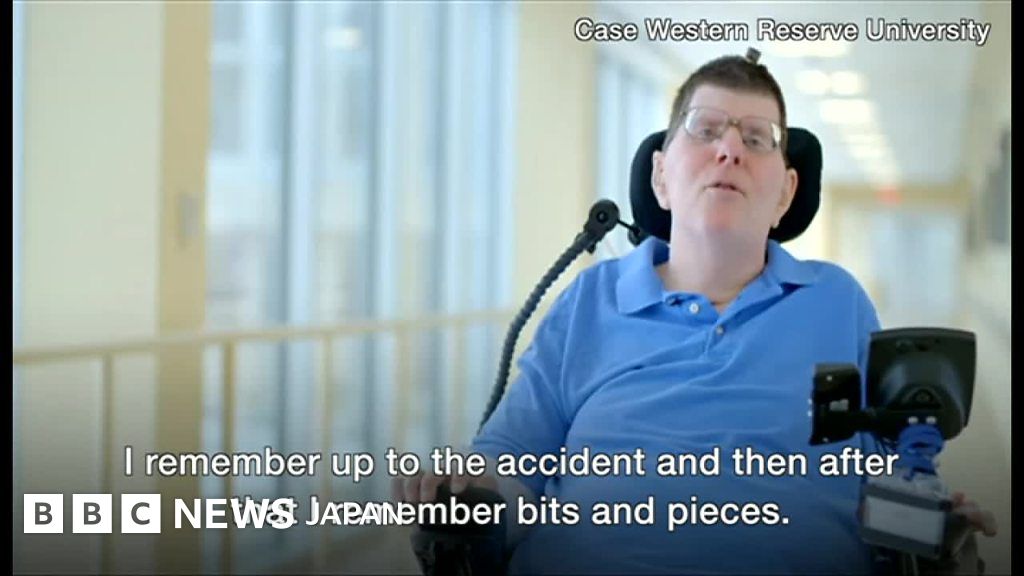 新しい脳インプラントシステムにより麻痺した男性の会話が可能に