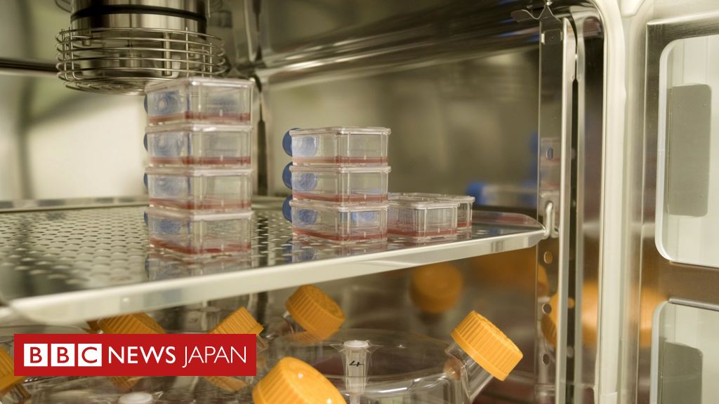 研究施設でつくられた血液、人体で臨床試験 英国で世界初 - BBC