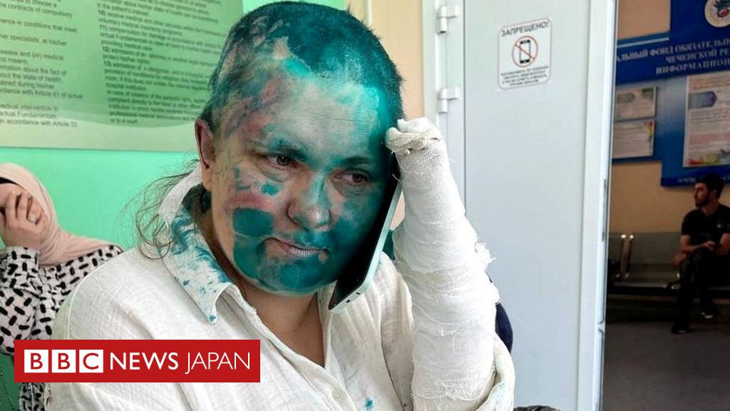 ロシアの独立系ジャーナリストと弁護士、チェチェンで襲われる