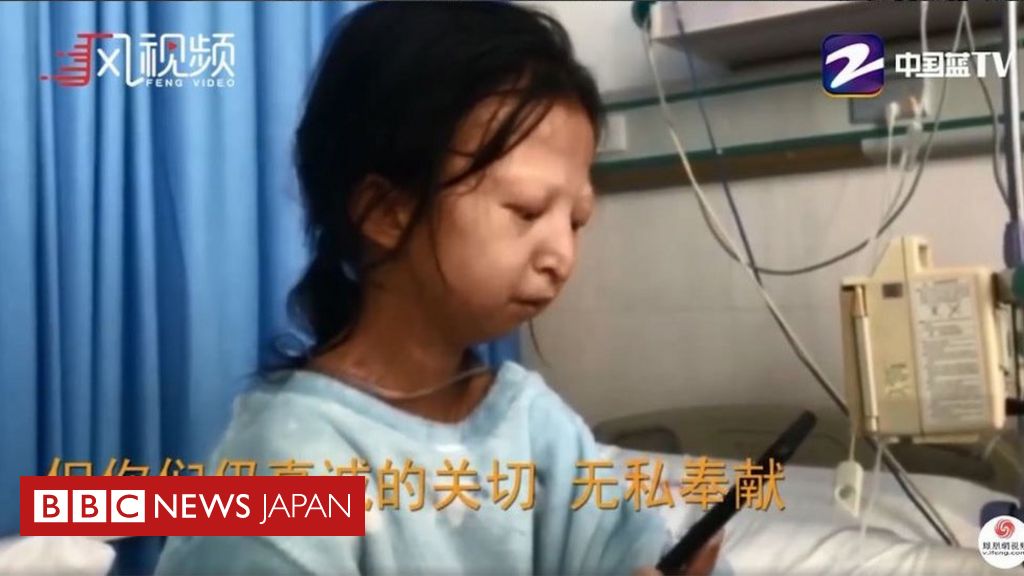 1日30円で生活の苦学生 障害ある弟を残し死去 中国 cニュース