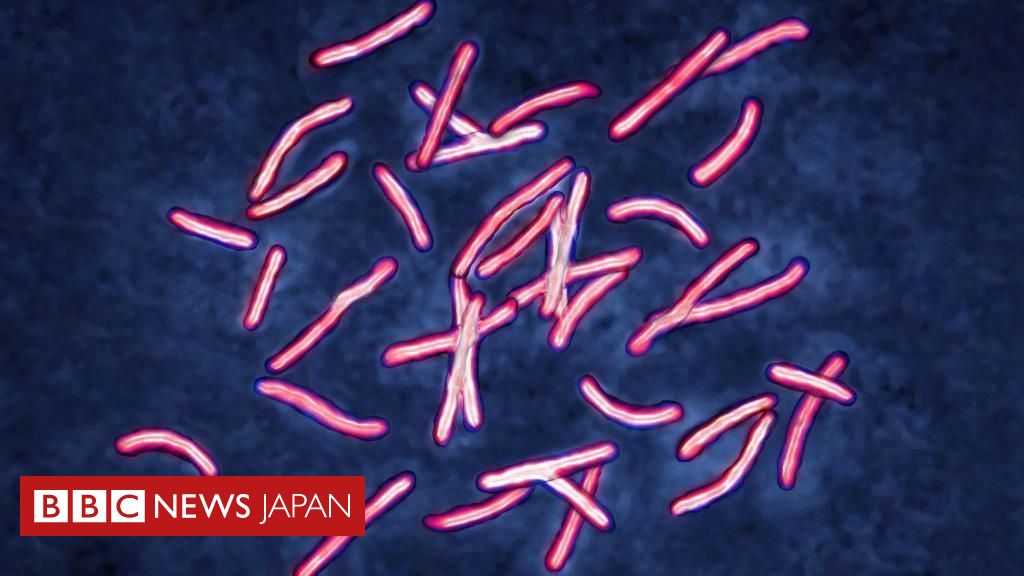 AIが「スーパー耐性菌」の難題を2日で解明　科学者が10年かけたのと同じ結論に - BBCニュース