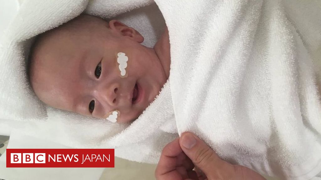日本の 世界最小の赤ちゃん が退院 すくすくと成長し体重は約12倍に cニュース