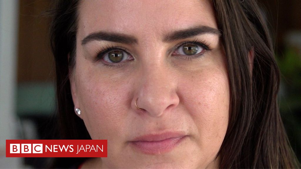 長期的なコロナ症状、記憶力や集中力にも影響 Bbcニュース