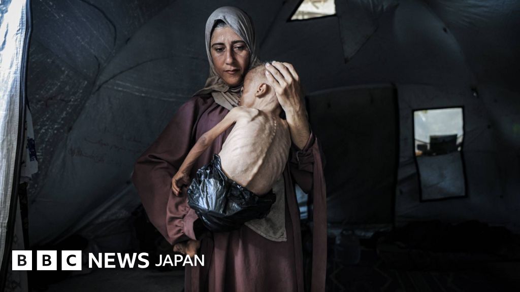 ガザで集団飢餓が拡大、住民が「どんどん衰弱」と人道団体が警告 - BBCニュース