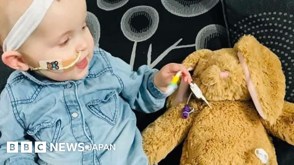 管の入ったぬいぐるみ 子供の病気の理解助ける 英スコットランド cニュース 管の入ったぬいぐるみ 子供の病気の理解助ける 英スコットランド cニュース