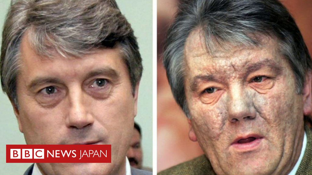 ロシアによる毒殺未遂 元ウクライナ大統領の場合 Bbcニュース