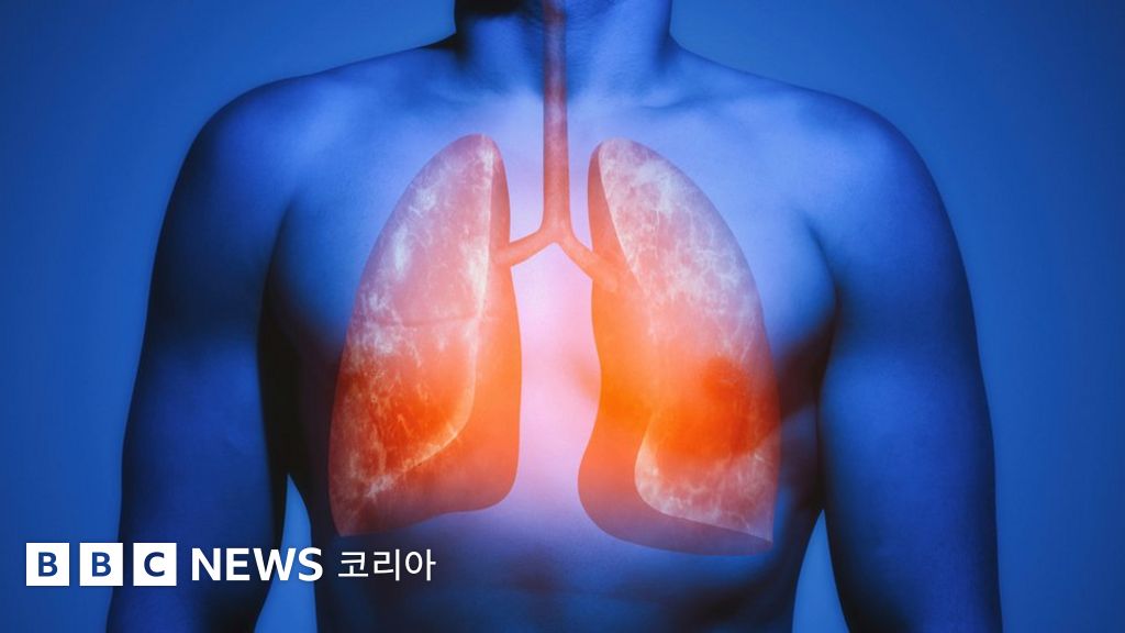 폐가 흡연으로 인한 손상을 '마법처럼' 복구할 수 있다는 게 밝혀졌다 BBC News 코리아