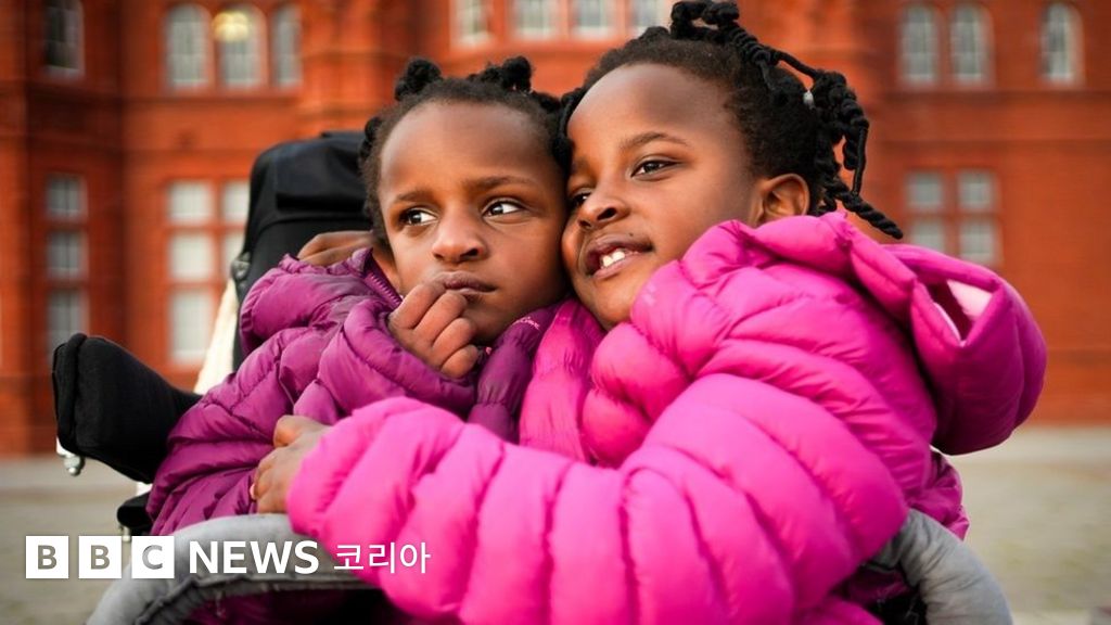 결합쌍둥이 자매, 7번째 생일을 축하하다 - BBC News 코리아