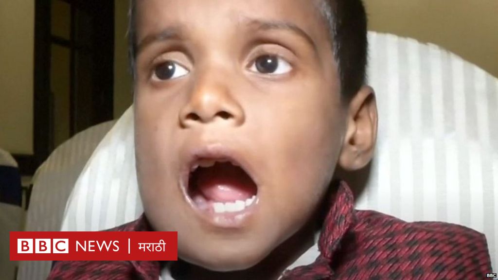 Мальчик который вывел 100 человек. Мальчик из Индии с 526 зубов. Мальчик с огромными зубами. Зубы из мальчиков. Мальчик с большим количеством зубов.