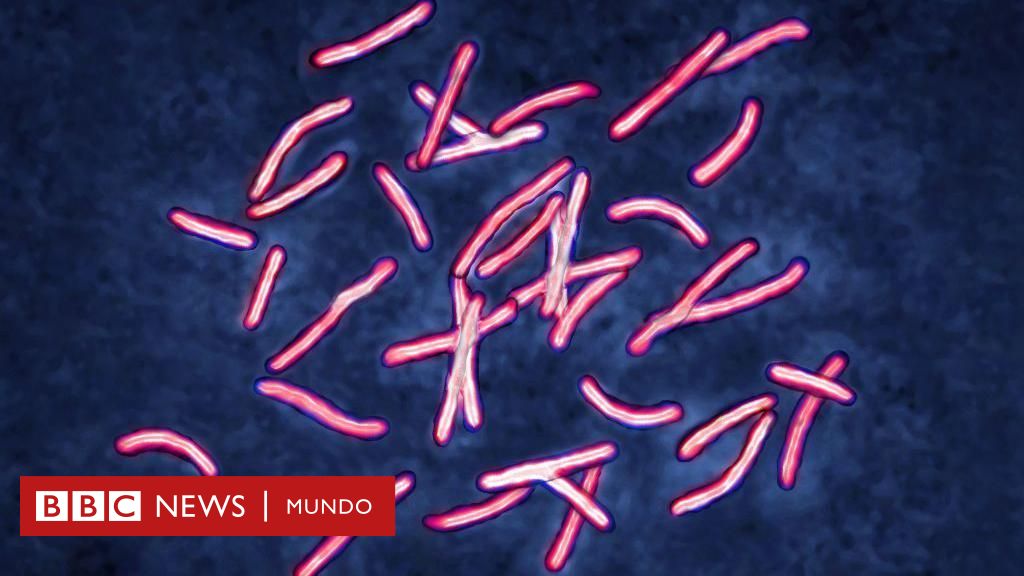 El problema sobre superbacterias que tomó años para ser resuelto por los científicos y que la IA solucionó en dos días