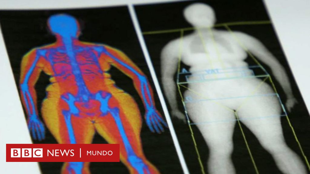 como se llama medir la grasa corporal como se llama medir la grasa corporal