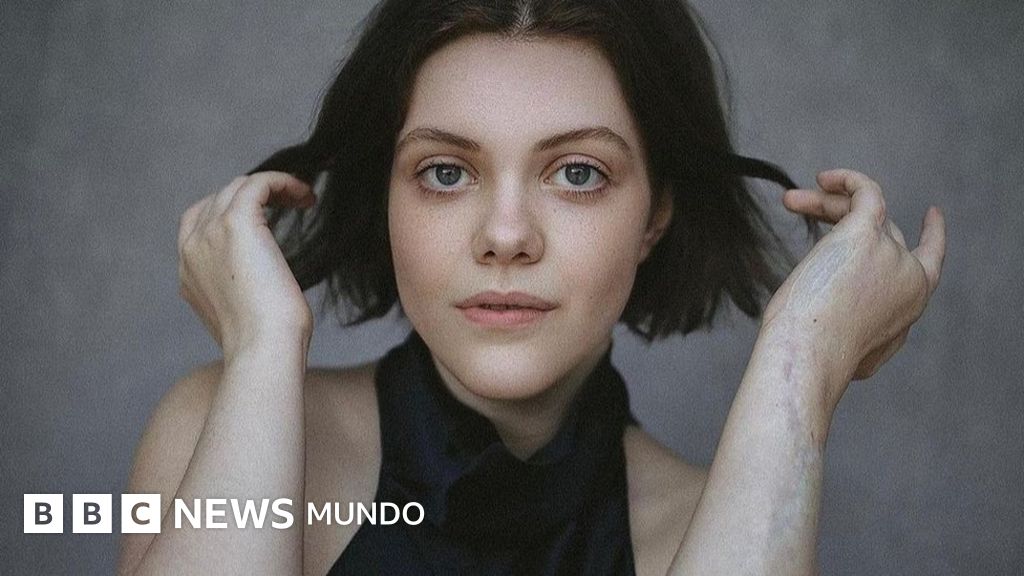 La infección "carnívora" que sufrió la actriz Georgie Henley y que casi "cobra" su vida