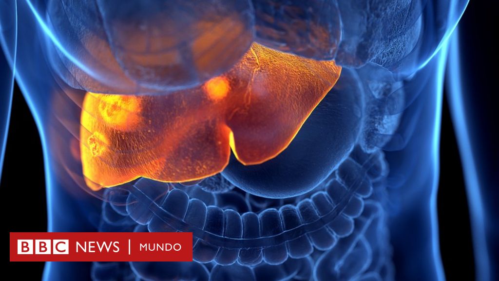 Detectan En Argentina El Primer Caso En América Latina De La Hepatitis 0481