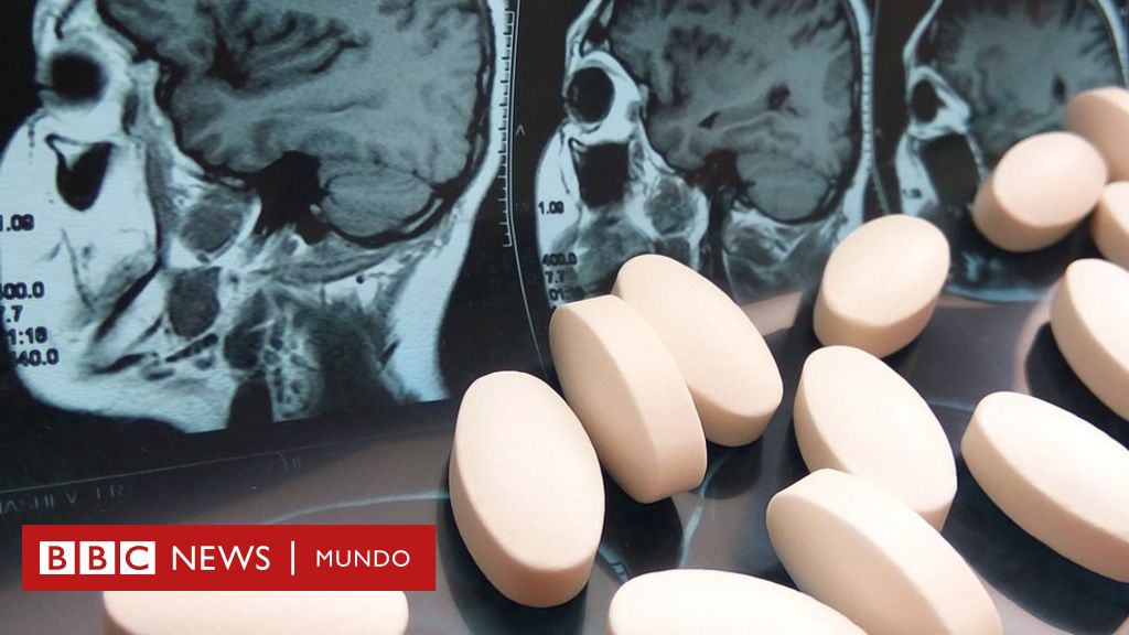 Puedes obtener una radiografía de tu control cerebral