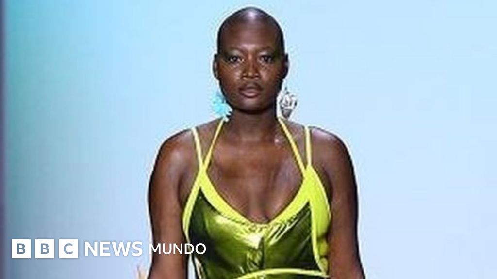 Mama Cax, la modelo negra y con discapacidad que luchó por la inclusión en la moda y murió a los 30 años (y que homenajea Google)