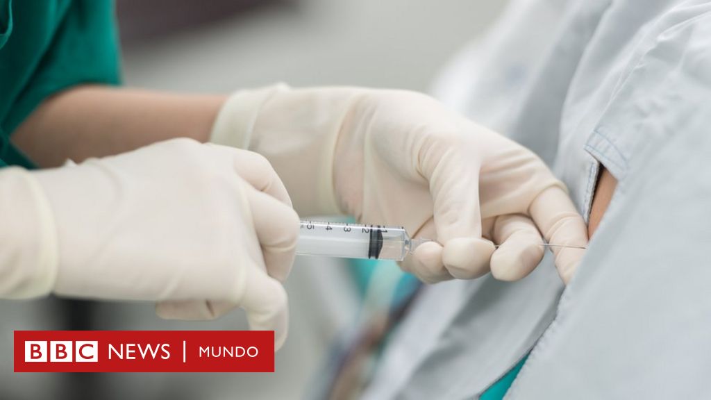EE.UU. y México alertan por un brote de meningitis en clínicas fronterizas donde practican cirugías estéticas