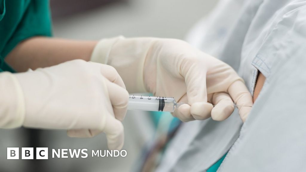 EE.UU. y México alertan por un brote de meningitis en clínicas fronterizas donde practican cirugías estéticas