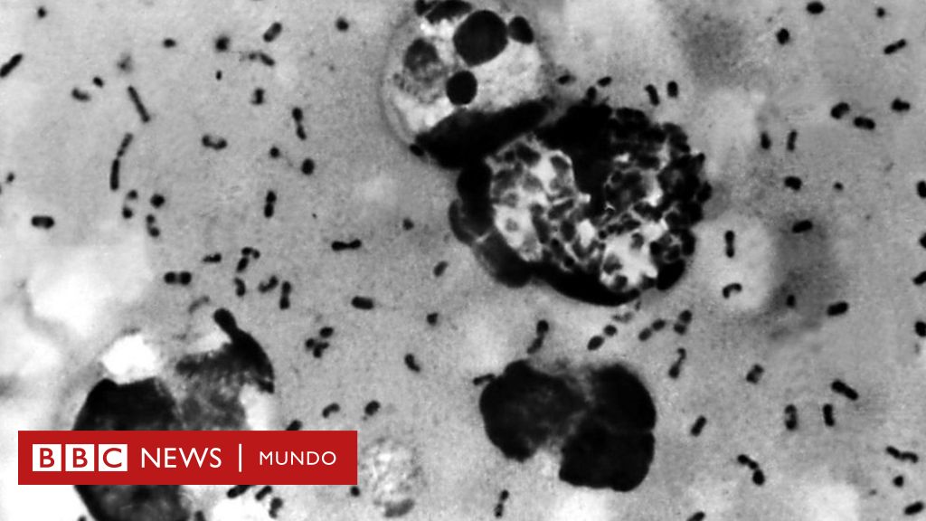 Dientes antiguos revelan por fin dónde se originó la peste negra, la más mortífera de la historia