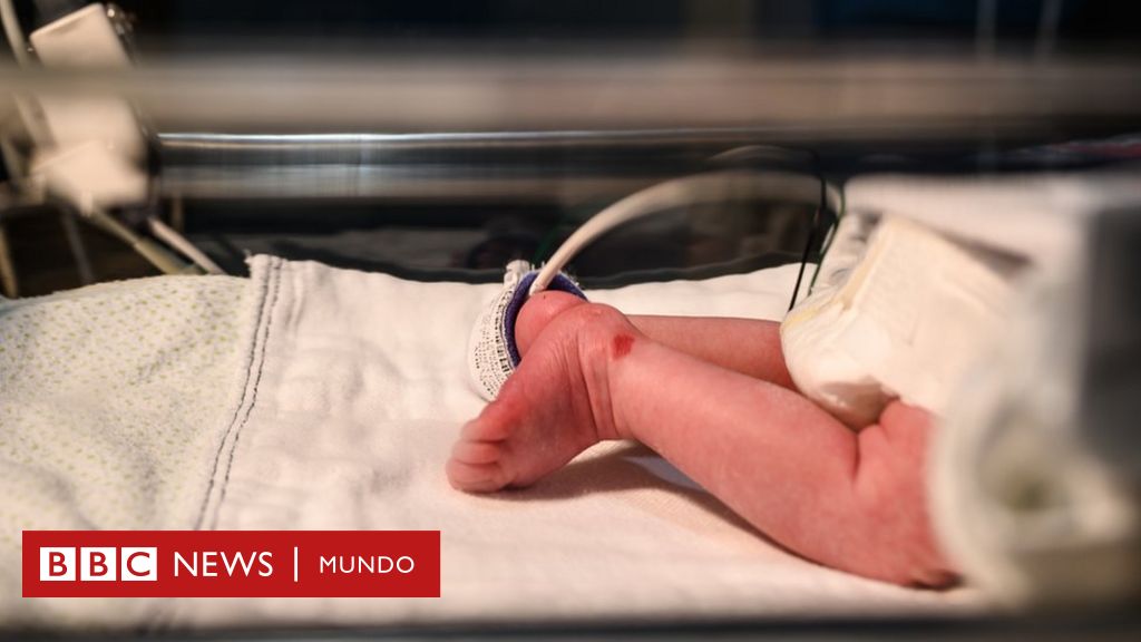 Ittiosi Arlecchino: una malattia rara in un bambino di 4 mesi abbandonato in un ospedale in Italia (e ora in molti vogliono adottarlo)