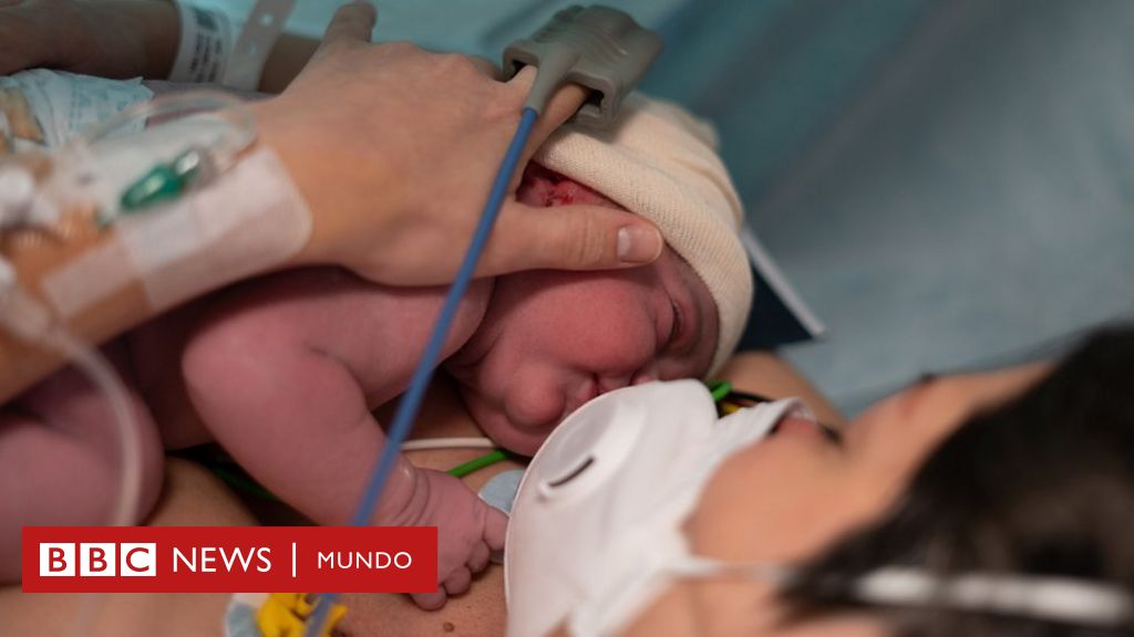 Coronavirus El Caso Que Confirma Que El Covid 19 Si Puede Transmitirse De Una Madre A Su Hijo Por La Placenta c News Mundo