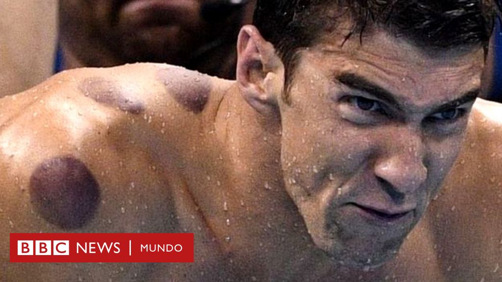 2016: ¿qué son círculos rojos la espalda del nadador Phelps y otros atletas olímpicos? - BBC News Mundo