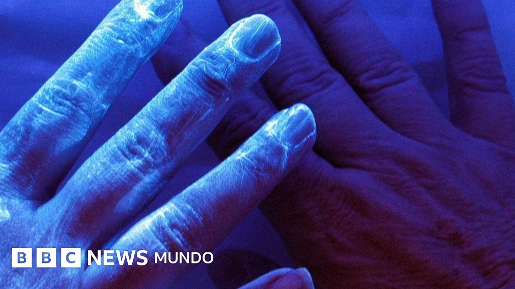 fotos de errores microscópicos en humanos