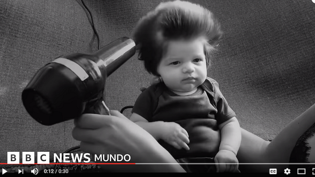 La caída de los cabello los granos a la cabeza