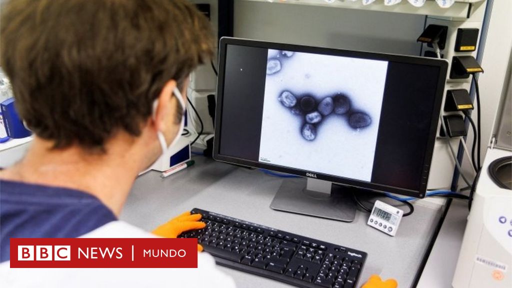 Viruela del mono: Argentina y México confirman los primeros casos de pacientes con la enfermedad en América Latina