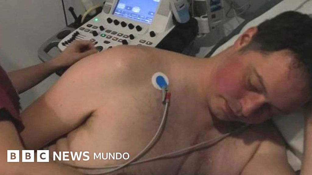 “Me dijeron que el corazón me dejaría de funcionar en un año”: el periodista de la BBC que se sometió a un procedimiento pionero esperando un trasplante de corazón
