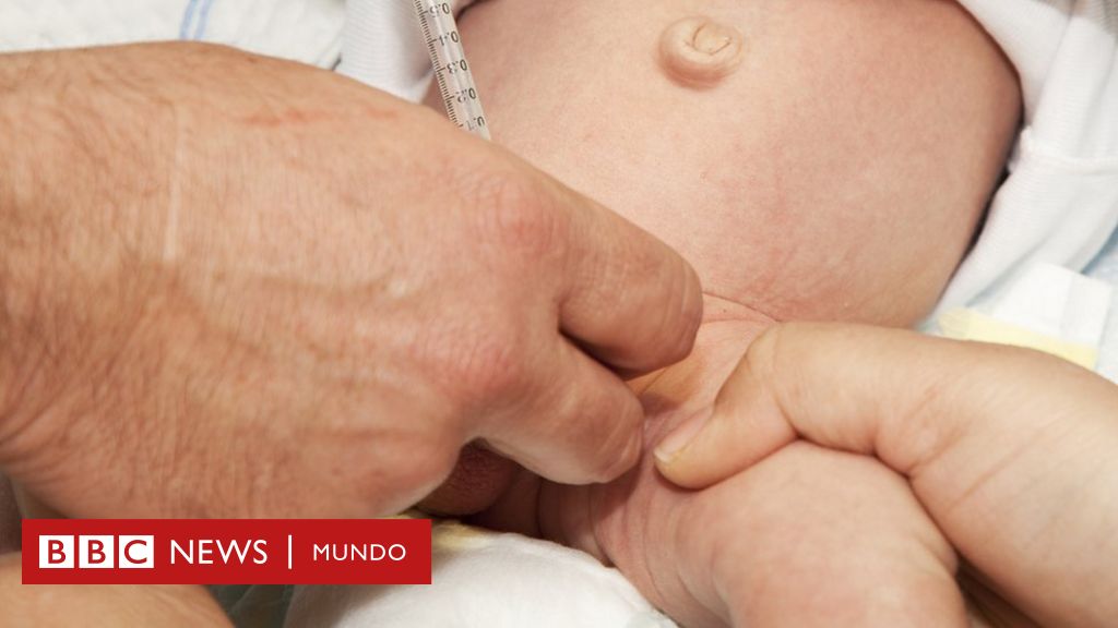 Un bambino di cinque mesi è morto a causa della circoncisione in casa in Italia