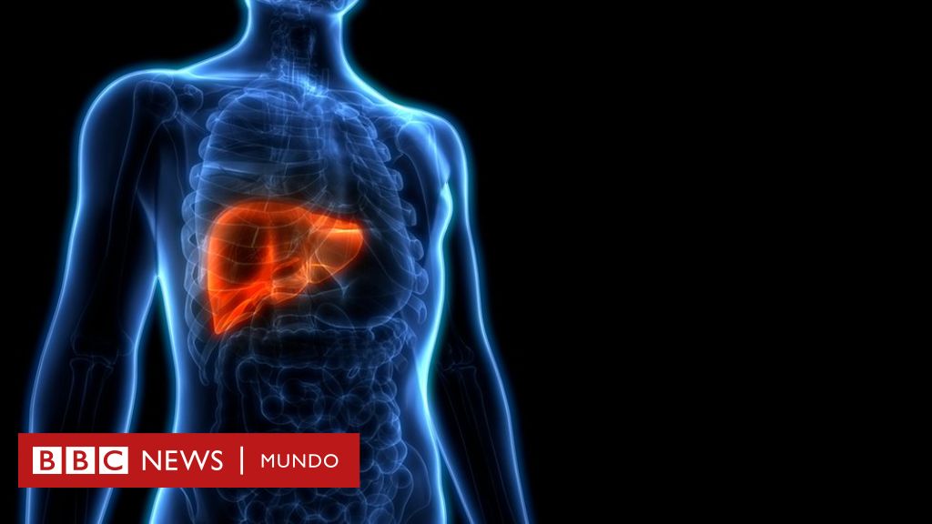Es la cirrosis de la muerte del hígado