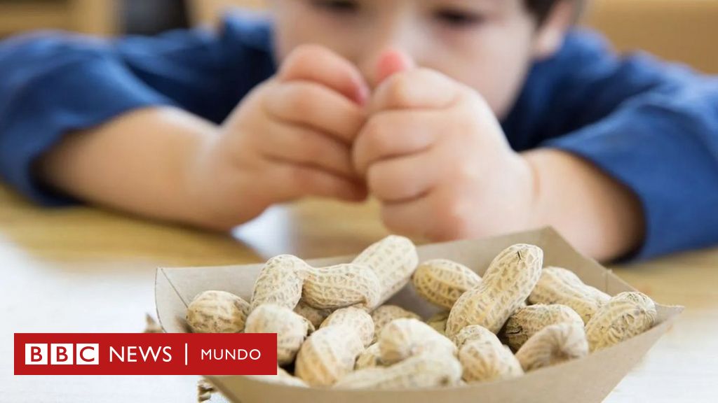 Alergias Alimentarias Niños Antofagasta