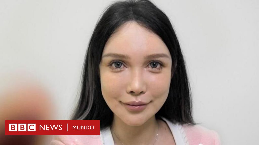 La obsesión por la cirugía estética: mi experiencia con más de 100 operaciones