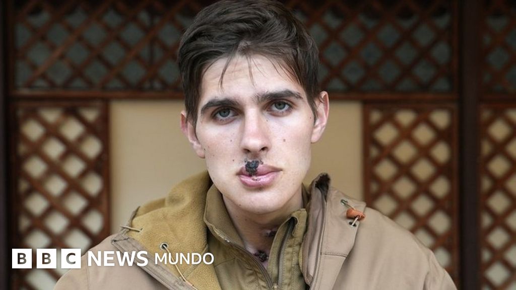"Mi hermano me salvó la vida, pero perdió la suya": el duro testimonio de un soldado ucraniano
