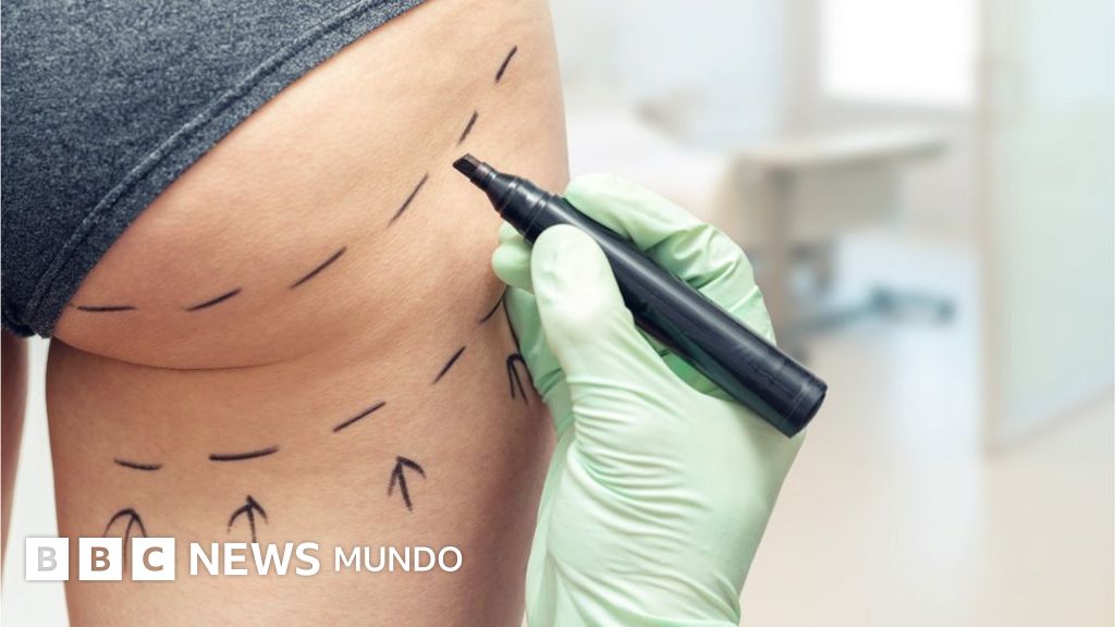 dolor en la ingle 6 semanas después de la sección c dolor en la ingle 6 semanas después de la sección c