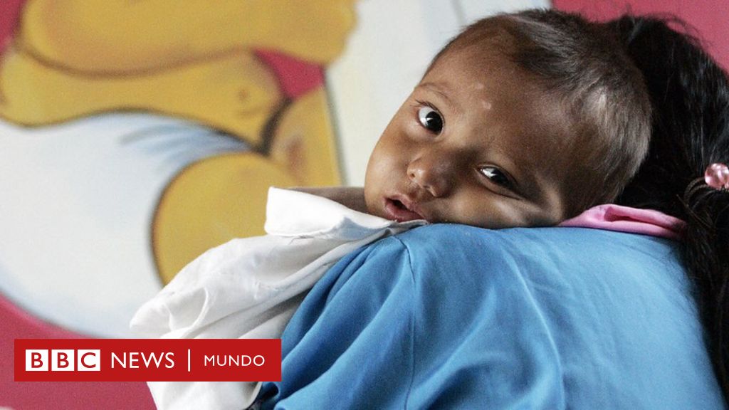 Desnutrición En Guatemala Por Qué Los Niños De Este País Son Los Que Más Desnutrición Crónica 0681