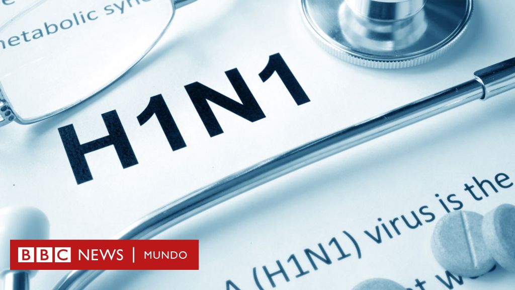 Gripe Española Gripe Porcina Influenza H1n1 ¿de Dónde Vienen Los Nombres De Las