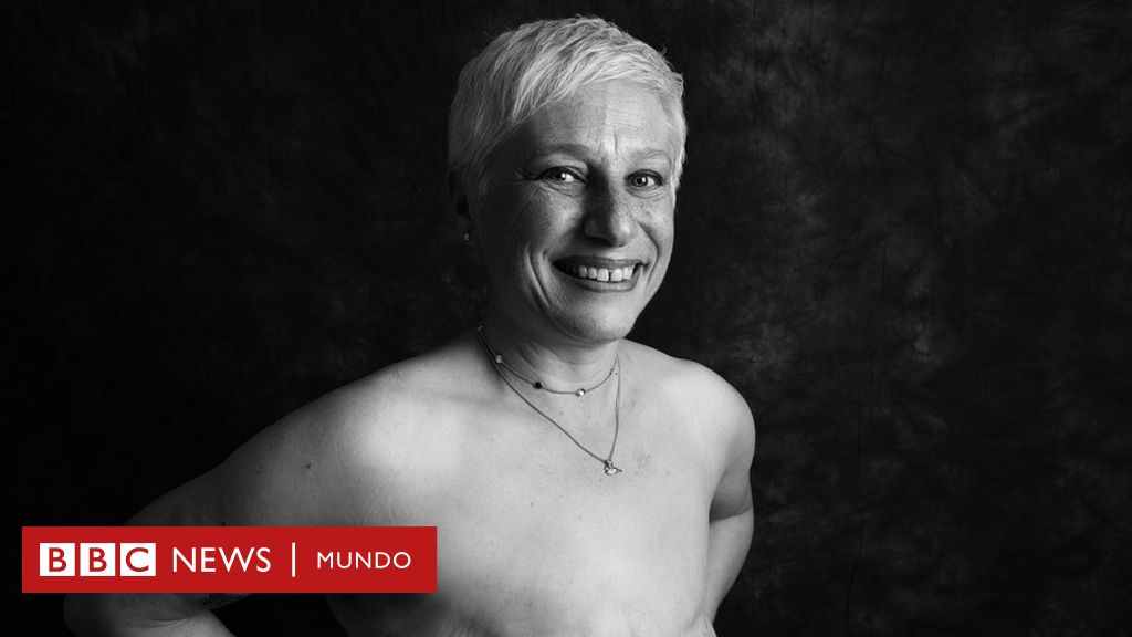Una sobreviviente de cáncer se suma a las quejas por el uso de su imagen en campaña para visilibilizar la diversidad de cuerpos en España