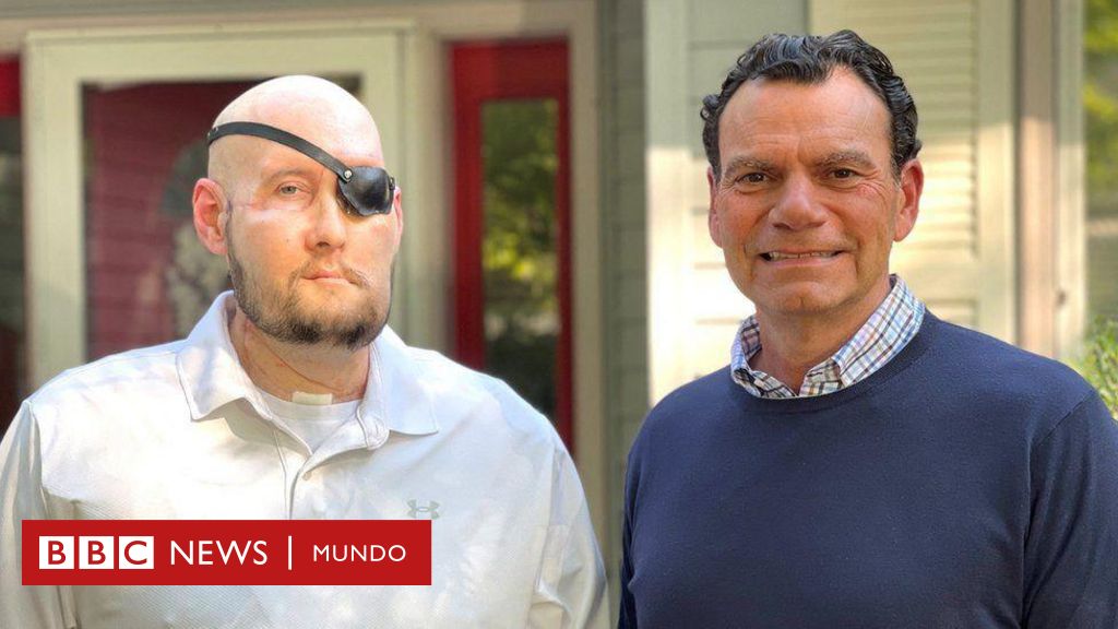 Ahli bedah Amerika berhasil melakukan transplantasi mata pertama di dunia