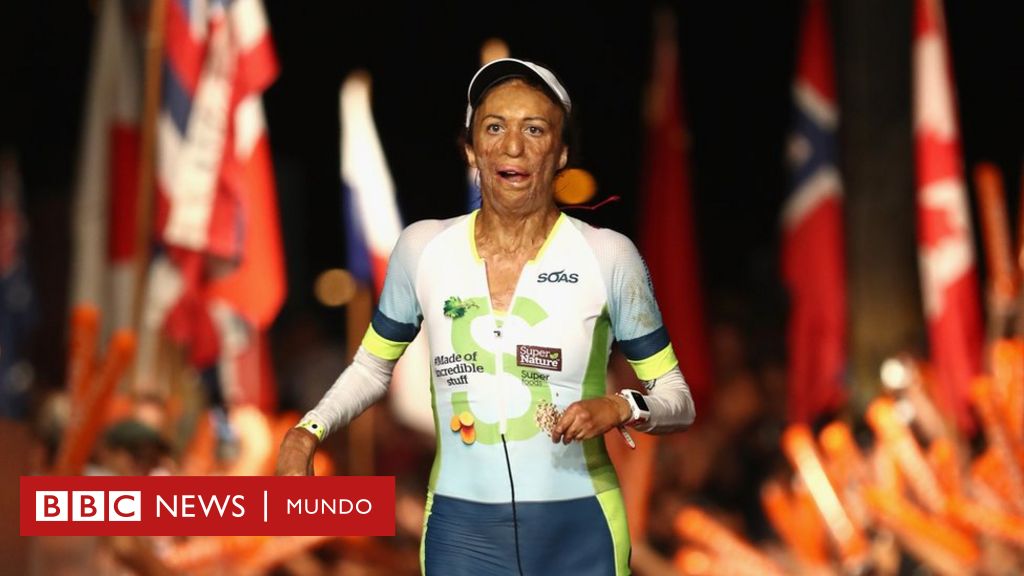 La extraordinaria hazaña de Turia Pitt, la mujer que pasó por 200  operaciones y logró terminar el triatlón más duro del mundo - BBC News  Mundo