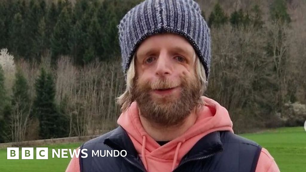 "Antes odiaba mi cara pero ahora estoy orgulloso de ella"