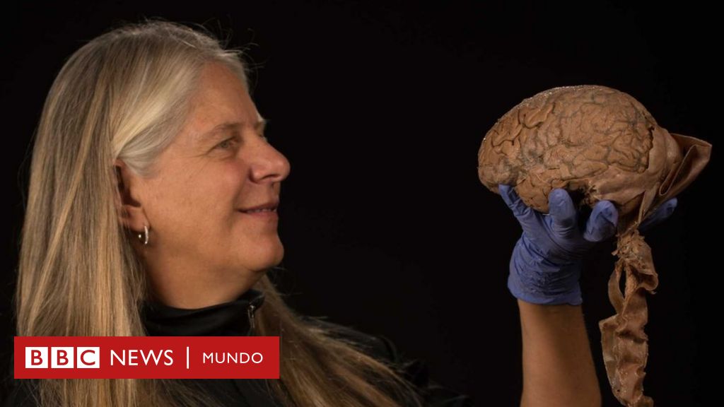 La asombrosa historia de la científica que por un derrame cerebral que la paralizó temporalmente hizo un gran descubrimiento