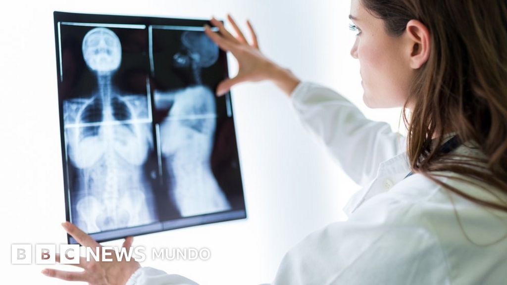Tumor cerebral náuseas diarrea