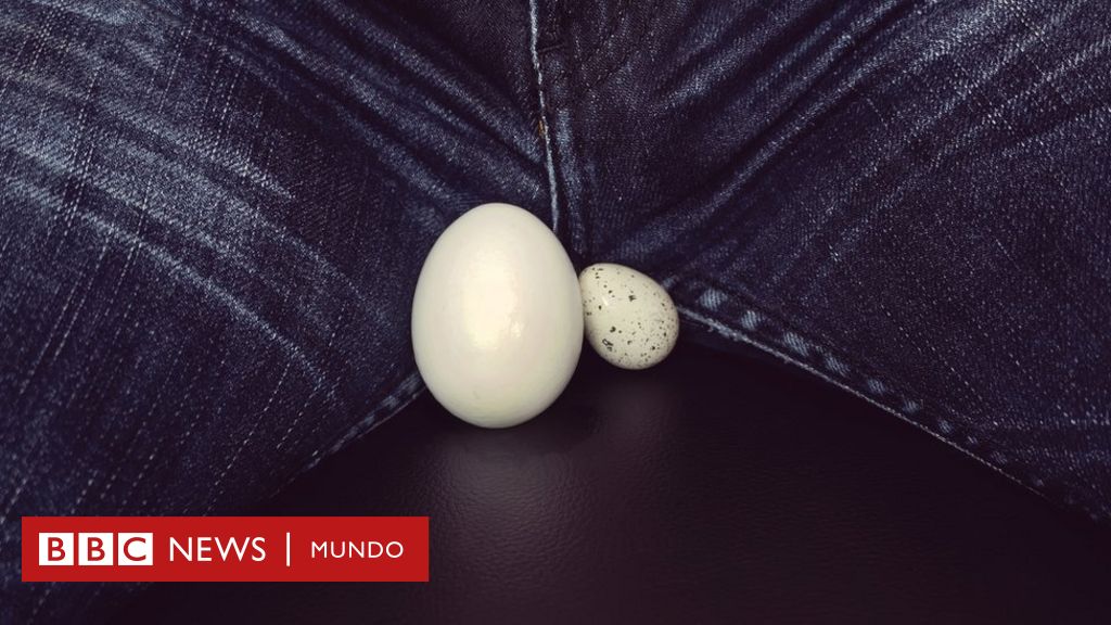 Sintomas varicocele testicular derecho