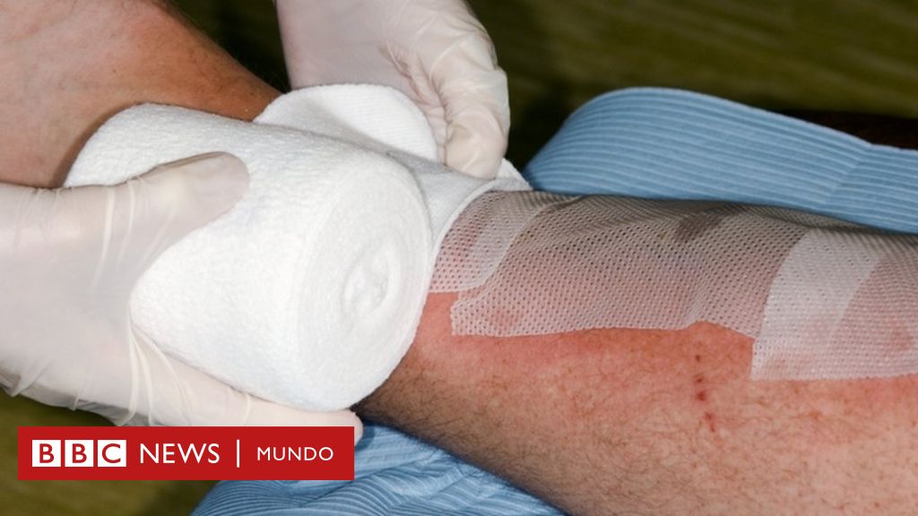 Por Qué Las Heridas Que Ocurren De Día Se Curan Más Pronto Que Las Que