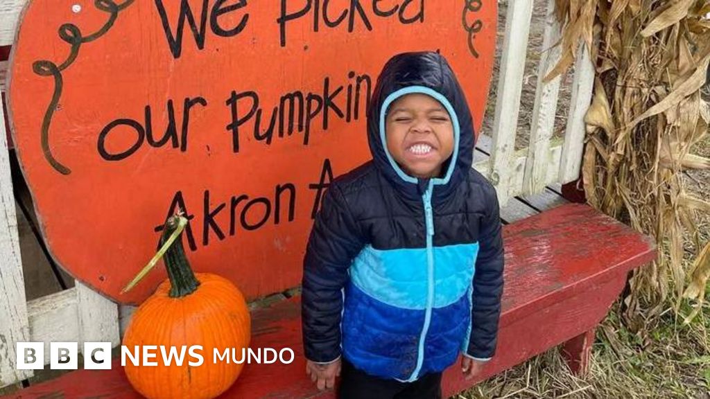 米国「私も同じようにしてほしい」：5歳児に肝臓の一部を提供する教師